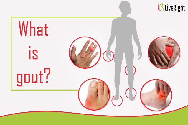 What is Gout ?