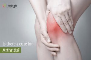 Is there a cure for Arthritis?