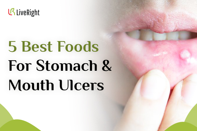 5 Best Foods For Stomach/Mouth Ulcers